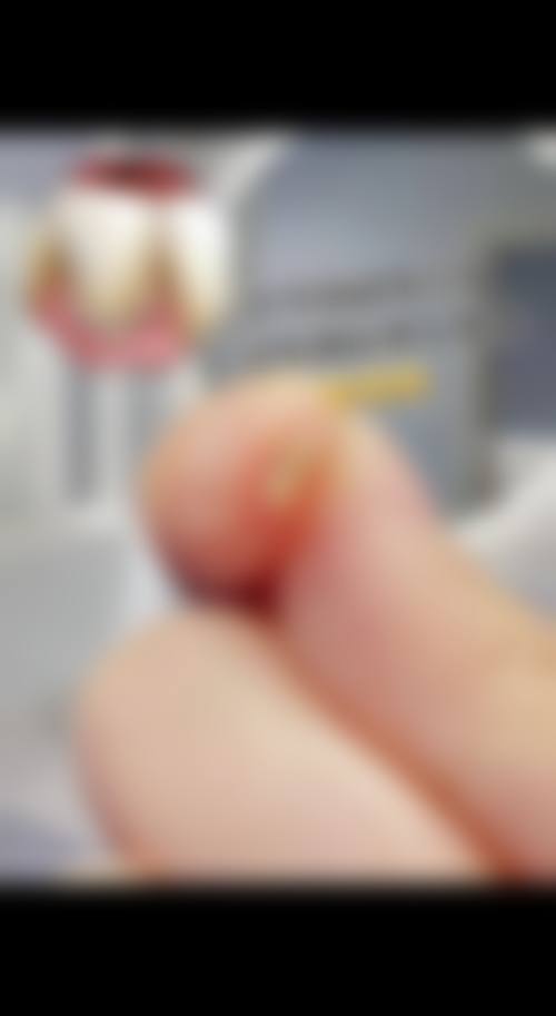 镇江维尔建口腔(宝华店)的补贴政策有哪些？
