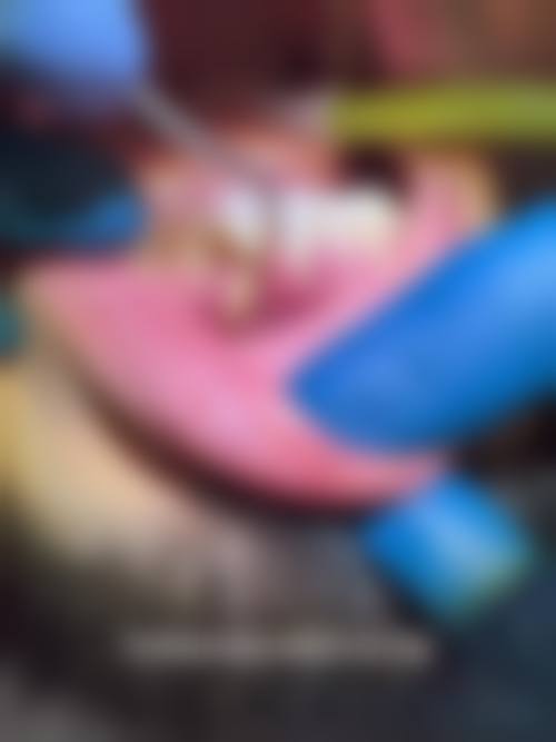 南宁创美口腔门诊部擅长项目。