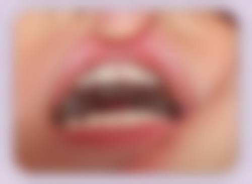 广西桂林明德口腔擅长项目。