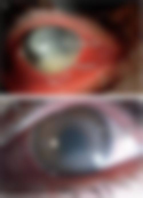 常见眼科项目市场参考价格
