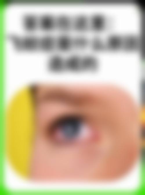 北京宜视康眼科医生团队经验稳定。