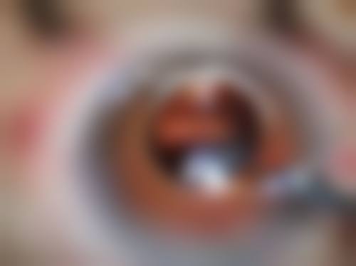 郴州市第一人民医院眼科门诊营业时间。
