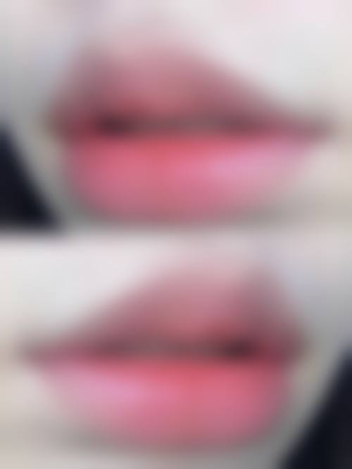 成都润美玉之光医疗美容门诊部擅长项目。