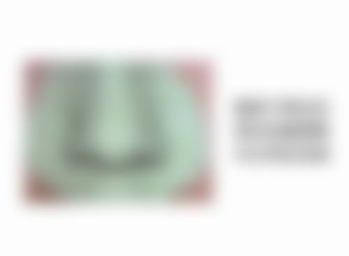 成都润美玉之光医疗美容门诊部治疗反馈与口碑评价。