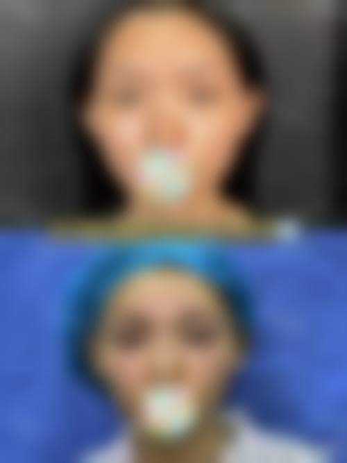 南京德美整形医疗美容门诊部擅长项目。