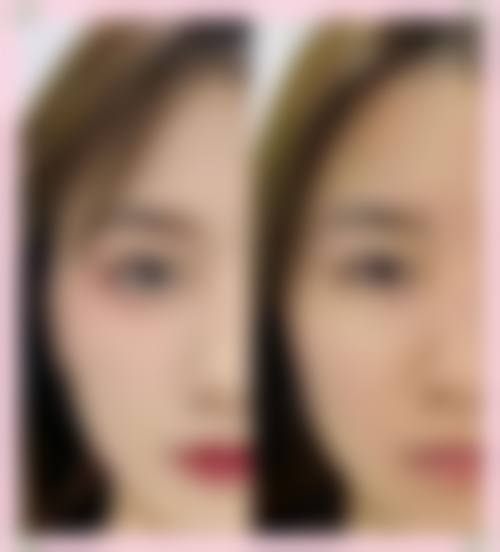 兰州奥世医疗美容诊所擅长项目。