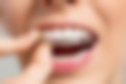 临床实例分享