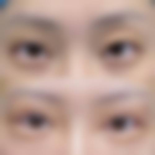 万州爱瑞阳光眼科医院如何预约挂号?