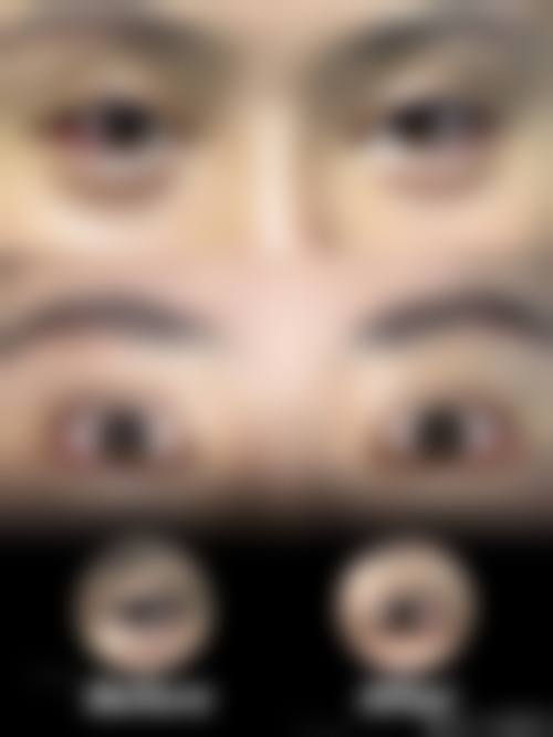 万州爱瑞阳光眼科医院医生团队经验稳定。