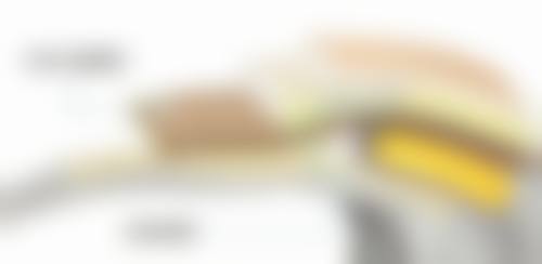 常见的去除烫伤疤痕的手术方法