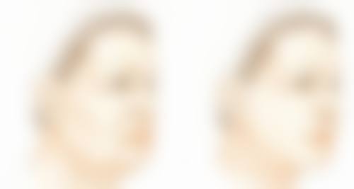 淮安俏美整形医院技术好不好?