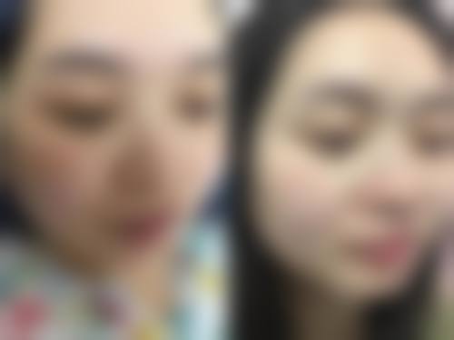 设备环境与服务流程:打造舒适医美体验
