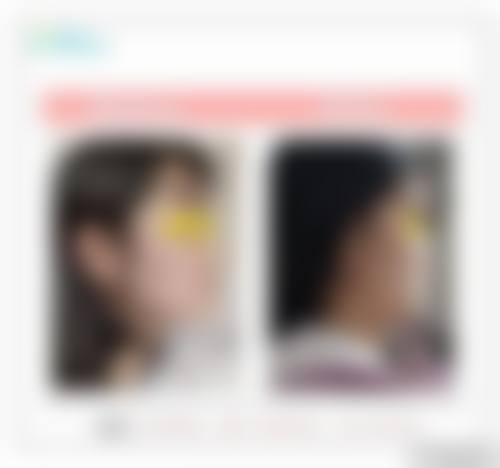 成都妍美辰医疗美容诊所服务理念贴心周到。