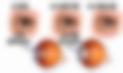 吕梁康明眼科医院擅长项目介绍