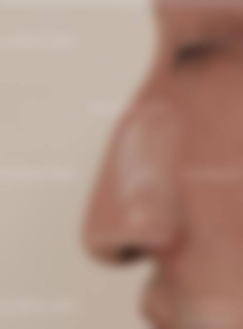 优惠活动详情——限时特别优惠