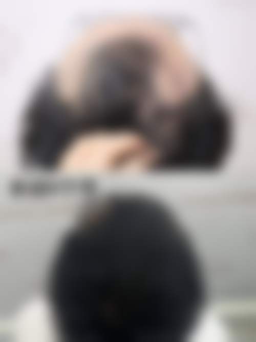 福州艾尚美医疗美容门诊部收费标准参考