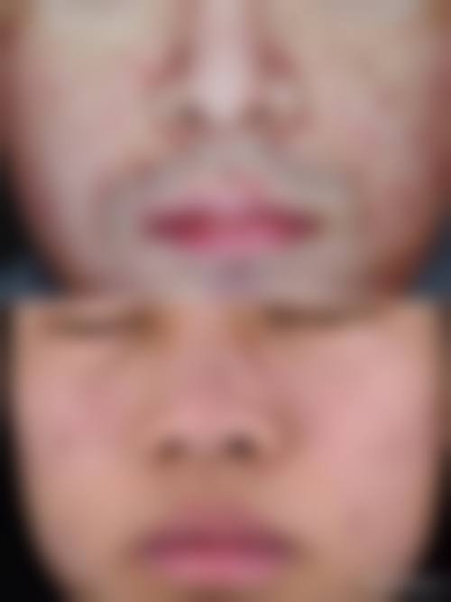 北京薇依医疗美容门诊部治疗反馈与口碑评价。