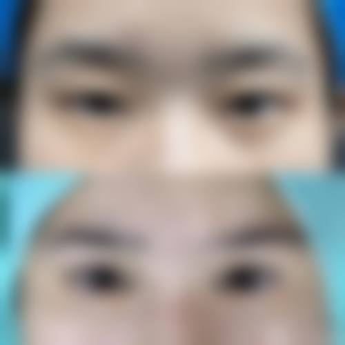 重庆聚积（豪眼力）眼科医院治疗反馈与口碑评价良好。