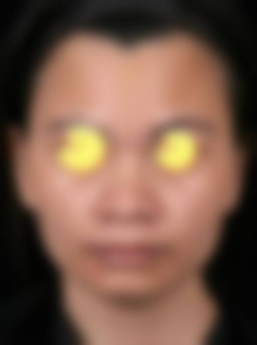 设备与环境介绍:国内外名列前茅诊疗设备让成效更精细