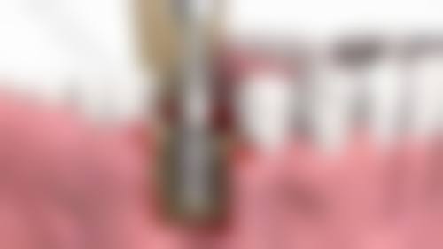 安徽省儿童医院口腔科预约挂号方式有哪些？