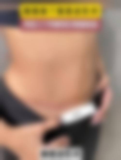 优惠活动详情:原价对比,到院更省