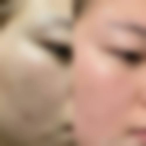 深圳齐美医疗美容诊所擅长项目。