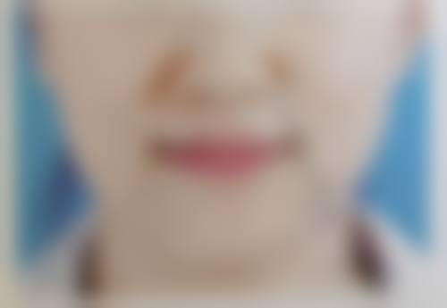 成都雍和华仁医疗美容整形门诊部治疗反馈与口碑评价。