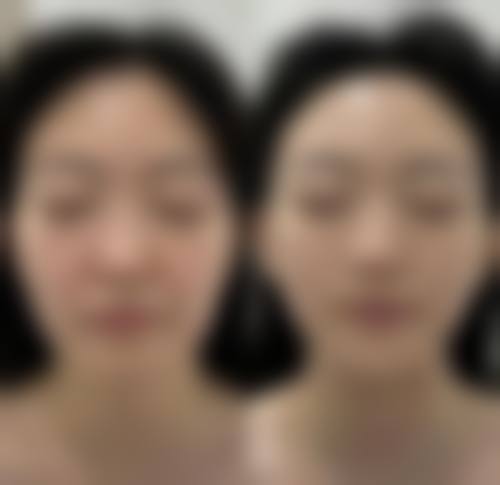 擅长项目详解