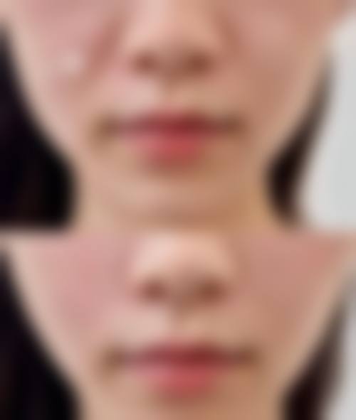 成都雍和华仁医疗美容整形门诊部擅长项目。