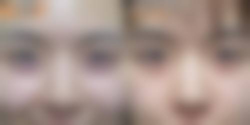 成都爱美保医疗美容诊所收费标准参考