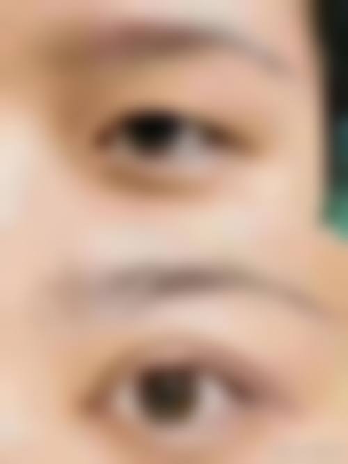 临床实例分享