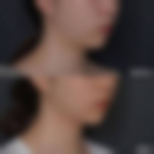 韩国NYPS整形外科医院擅长项目