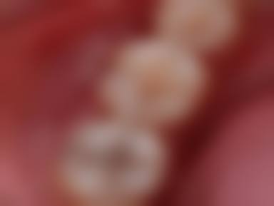 临床实例分享