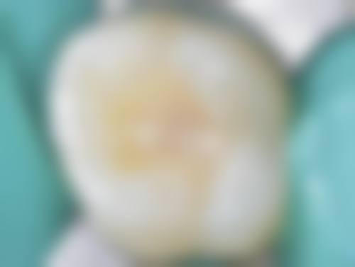 预约优惠活动
