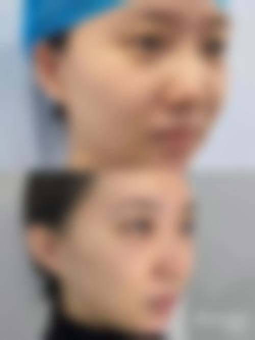 擅长项目详解
