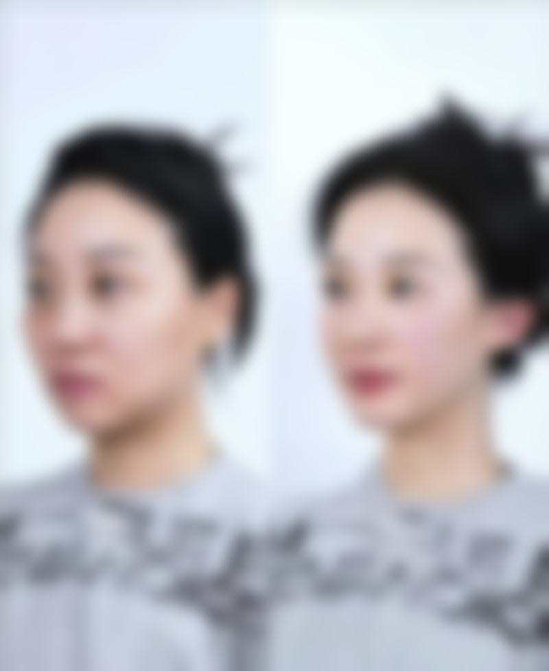 总结——长沙秀美医疗美容门诊部怎么样?