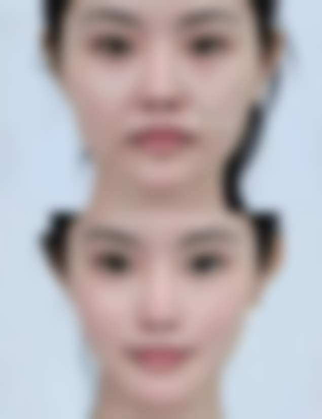 广州十三伊颜医疗美容诊所医院技术好不好？