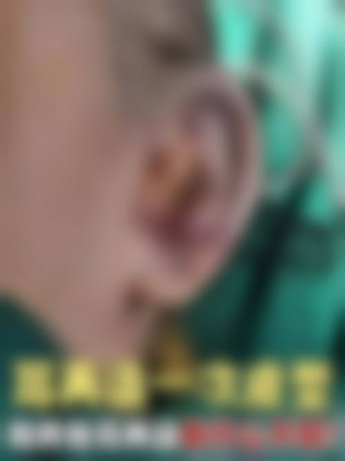 临床实例分享