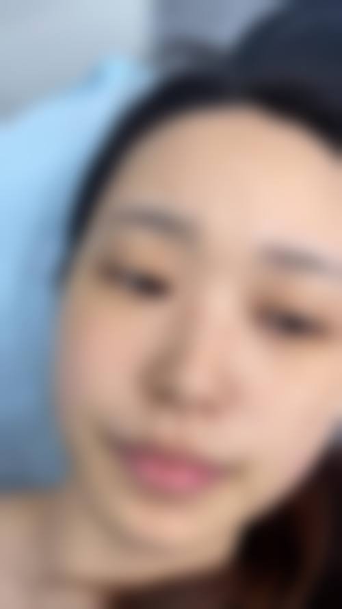 临床实例分享