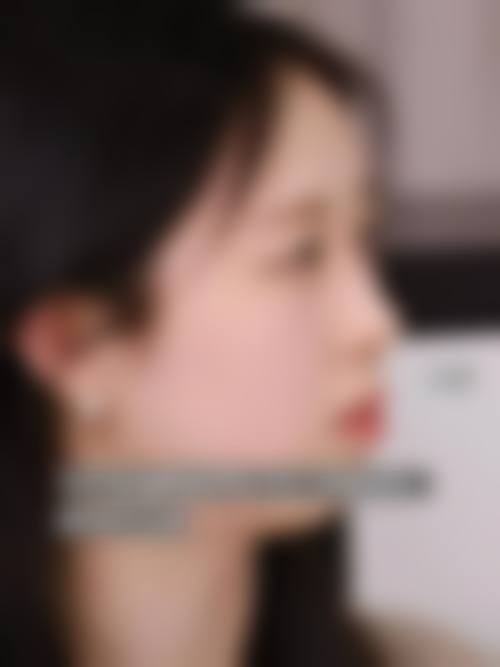 擅长项目详解