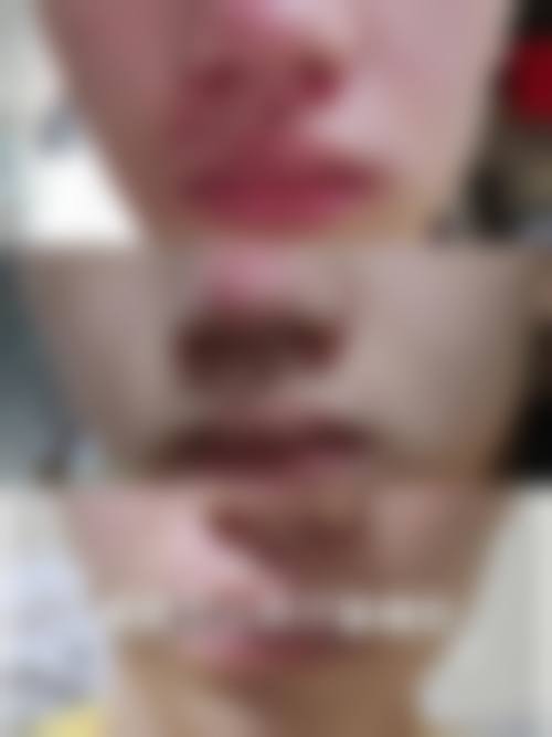 患者真实评价