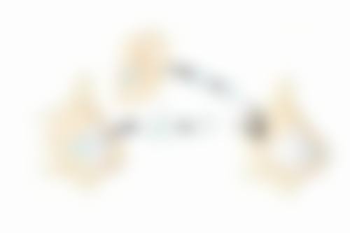 隆鼻两年稳定了吗,因人而异