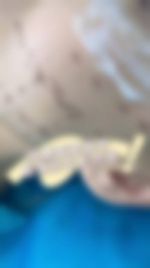 临床实例分享