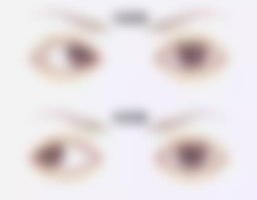 特色科室与项目:覆盖全眼科的诊疗体系