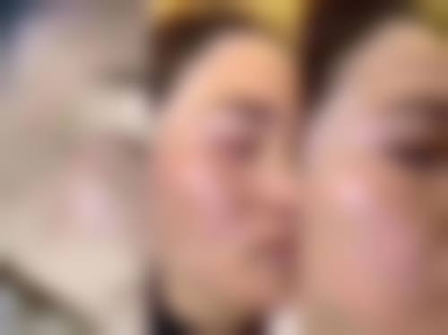 广州佳和医院血管瘤科擅长项目。
