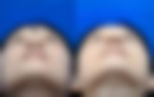 广州佳和医院血管瘤科就诊预约方式。