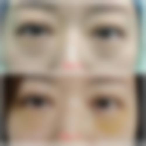 南京汐美荟美容诊所治疗反馈与口碑评价。