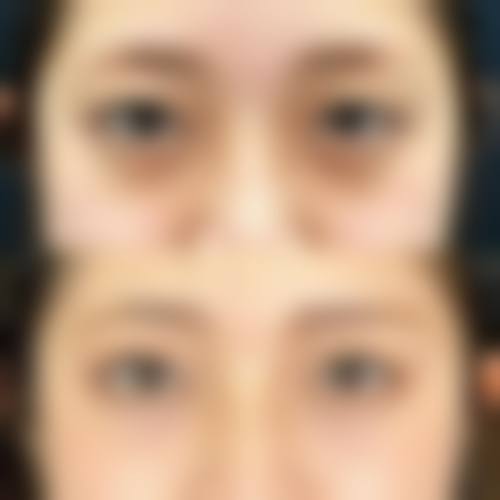 优惠活动详情与参考价格