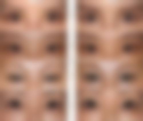 优惠活动详情:限时特别优惠,助力美丽蜕变