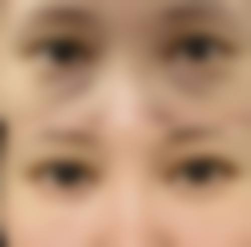 四平英俊医疗美容诊所擅长项目。
